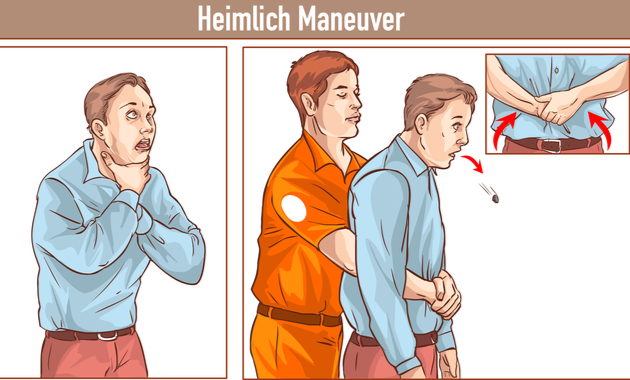 first-aid-for-choking